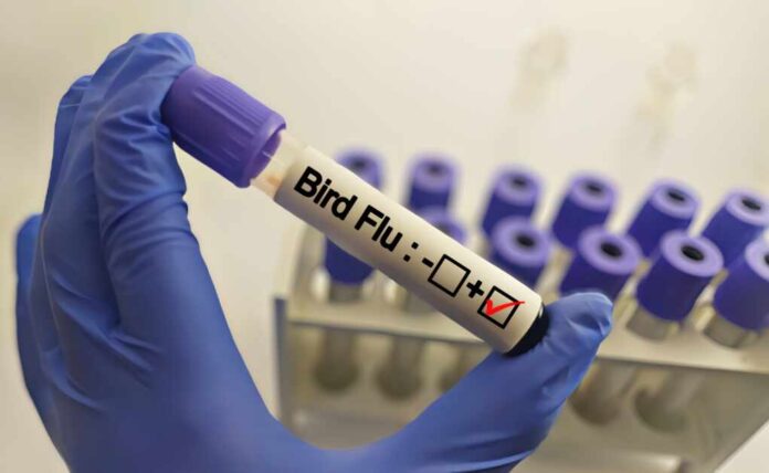 Doctor,Holding,A,Test,Blood,Sample,Tube,Positive,With,Bird