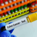 Gloved hand holding colon cancer test tube
