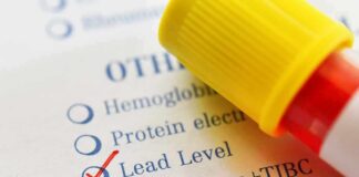 Blood sample tube on lab test form with lead level checked